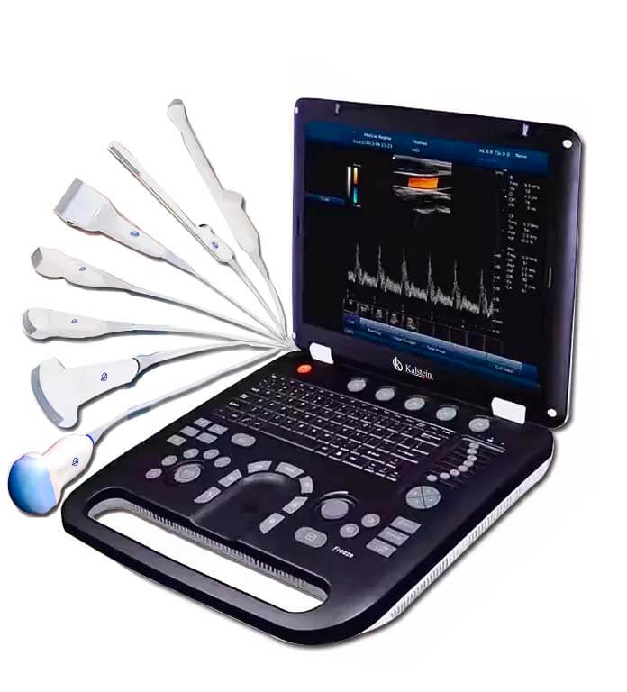 Garantía y vida útil esperada del ultrasonido Doppler color YR05152: Plan de reemplazo