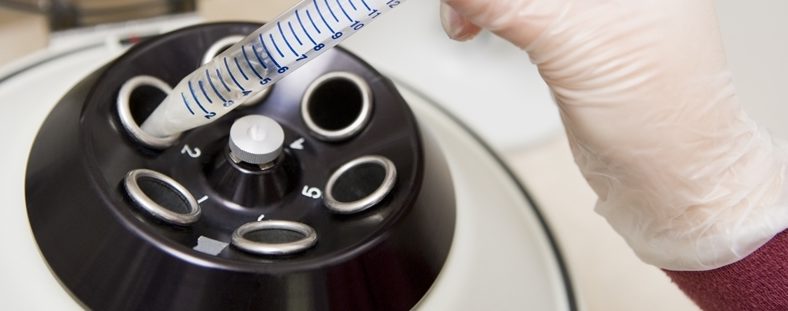 ¿Cómo actuar en caso de la rotura de tubos en el interior de una centrífuga?